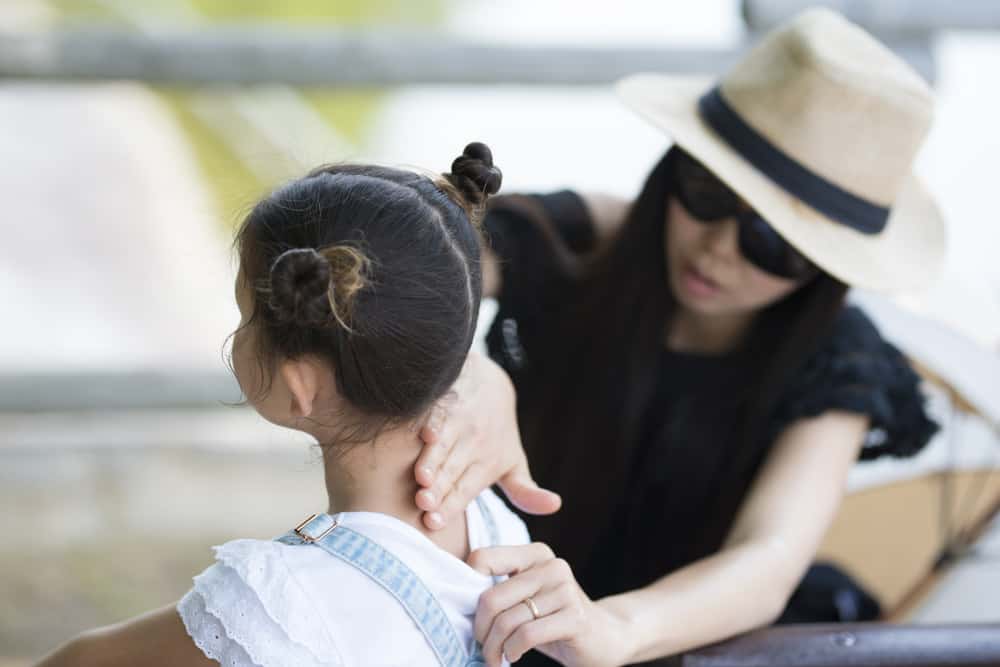 Paano Makaiwas Sa Sunburn, At Paano Ito Gamutin?